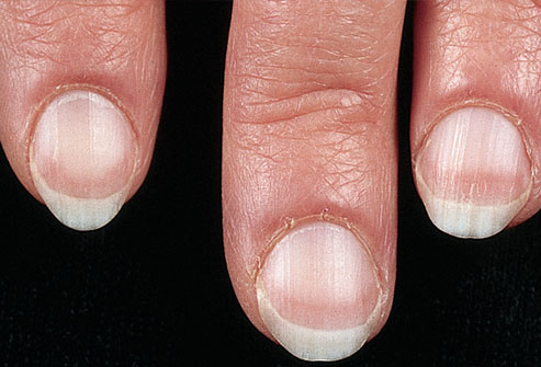 Problems in the liver, lungs, and heart can show up in your nails